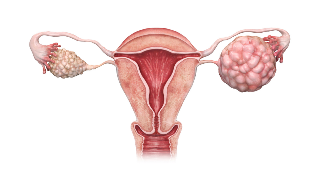 Homeopathic solutions for Hormone Disorders